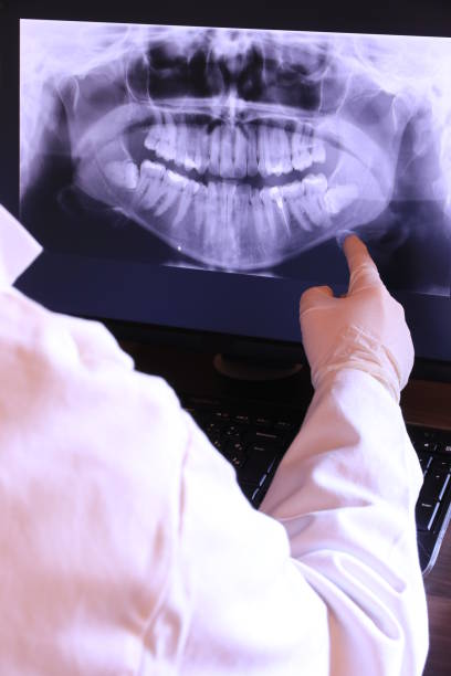 Best Emergency Wisdom Teeth Removal in Bethlehem, NC