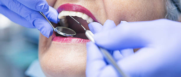 Best Emergency Dental Care for Broken or Chipped Teeth in Bethlehem, NC